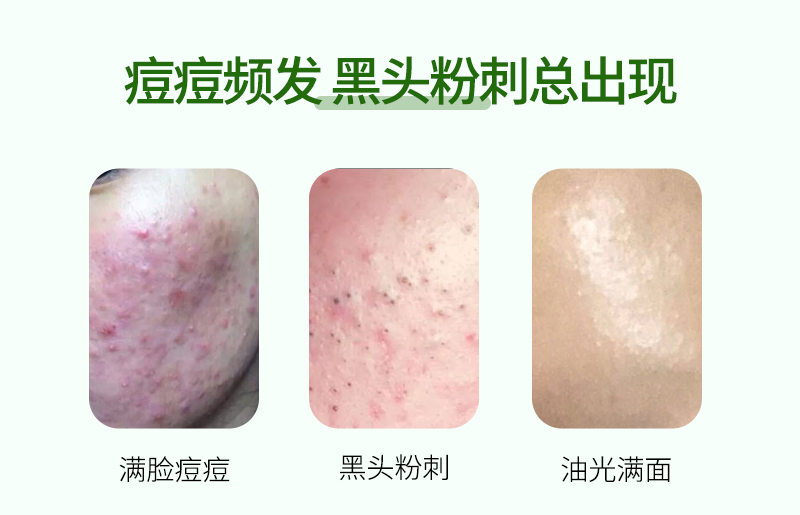 平衡净颜细致乳OEM详情页_04.jpg