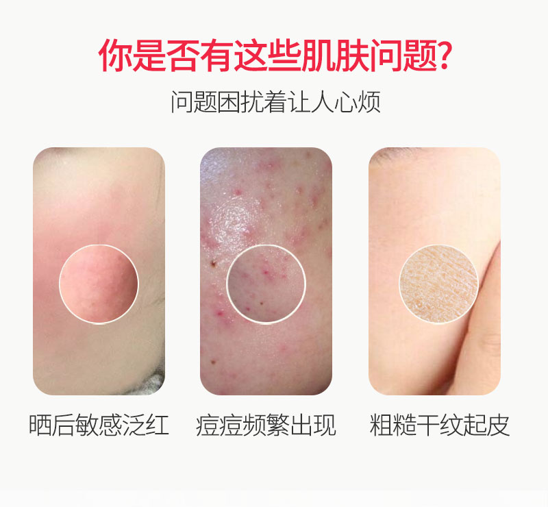 四维舒缓精华乳OEM详情_03.jpg